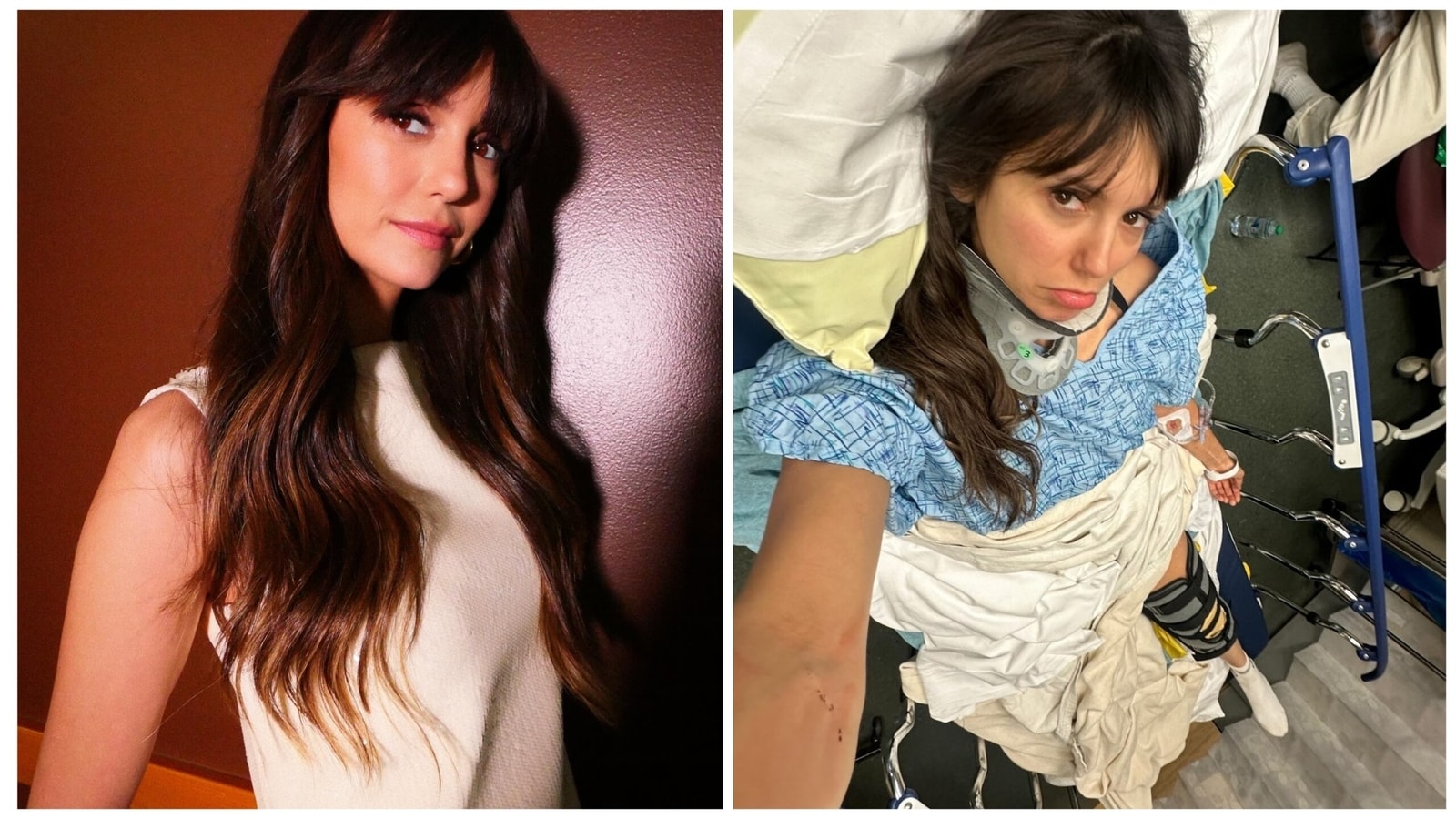 Nina Dobrev hospitalized after bike accident: Road to recovery is long