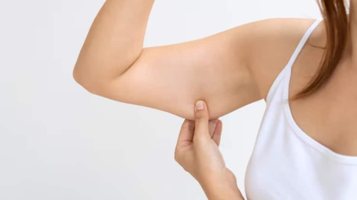 How to tighten and prevent saggy skin post weight loss with simple lifestyle hack and skincare tips

